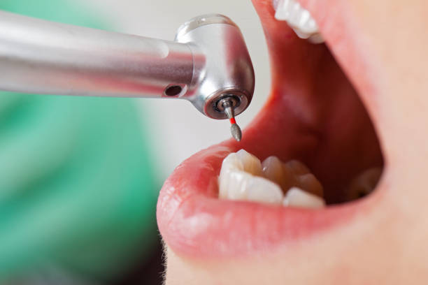 Best Broken or Chipped Tooth Repair in Silver Lake, KS